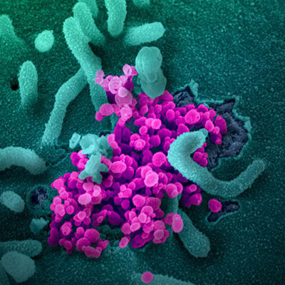 Coronavirus Company Actions